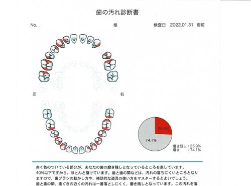 全顎の検査を受けた患者様に検査結果を紙でお渡しし、担当衛生士と現在の口腔内の状況を一緒に確認
